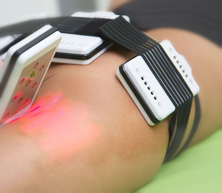 Behandlungsablauf mit dem SLIMSTYLER