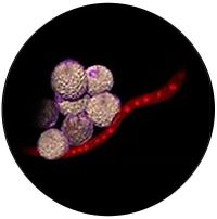 Wirkprinzip der SLIMSTYLER-Anwendung - Fettzellen sind nun gesünder und kleiner, während Adern unangetastet bleiben